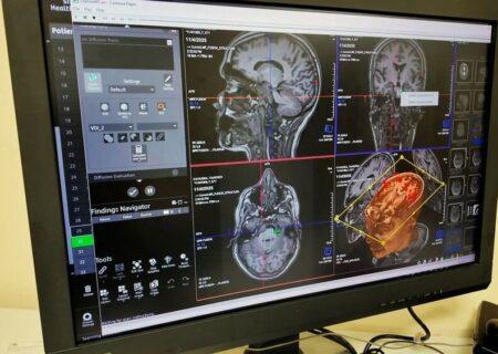 تجهیز نرم افزارهای پیشرفته واحد MRI بیمارستان سینا به همت خانواده یک خیر سلامت
