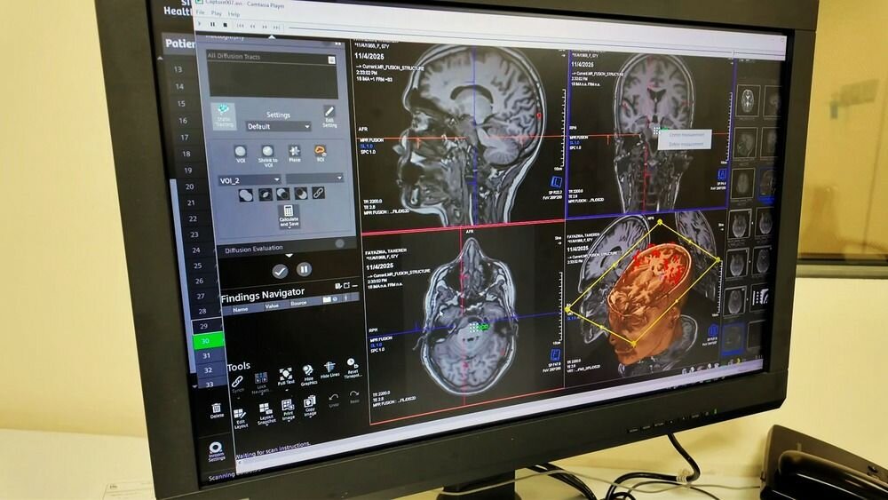 تجهیز نرم افزارهای پیشرفته واحد MRI بیمارستان سینا به همت خانواده یک خیر سلامت
